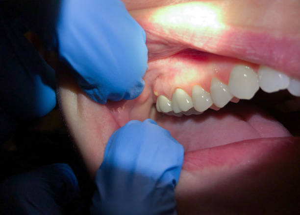 Best Emergency Dentist for Special Needs Patients in Massapequa, NY